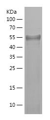    PPARGC1A / Recombinant Human PPARGC1A