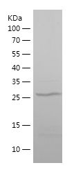    MECP2 / Recombinant Human MECP2