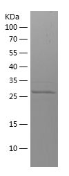    GRIN2B / Recombinant Human GRIN2B