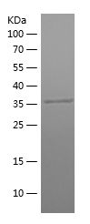    PGK1 / Recombinant Human PGK1