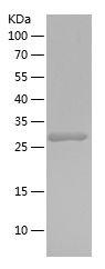    NEIL1 / Recombinant Human NEIL1