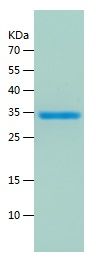    MARCKS / Recombinant Human MARCKS