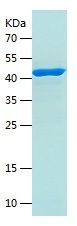    AP2A1 / Recombinant Human AP2A1