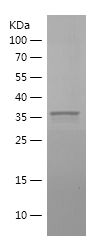    PHC2 / Recombinant Human PHC2