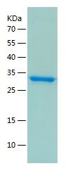    HSD17B10 / Recombinant Human HSD17B10