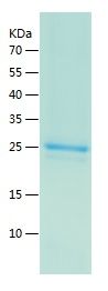    EXT2 / Recombinant Human EXT2