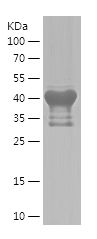    EML1 / Recombinant Human EML1