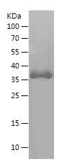    COL3A1 / Recombinant Human COL3A1