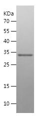    S100B / Recombinant Human S100B