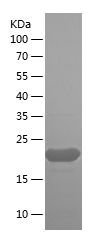    MRPL58 / Recombinant Human MRPL58