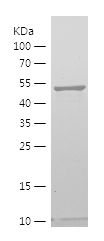    LATS2 / Recombinant Human LATS2