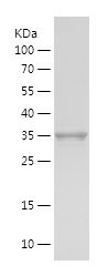    LPL / Recombinant Human LPL