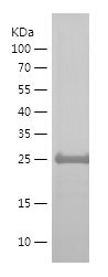    MANBAL / Recombinant Human MANBAL