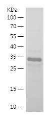    CDKN1B / Recombinant Human CDKN1B