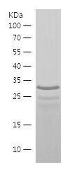    SCARF1 / Recombinant Human SCARF1