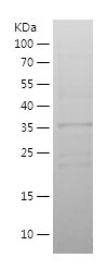    NRDE2 / Recombinant Human NRDE2