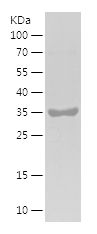    LYZ / Recombinant Human LYZ