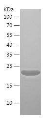    FINE-N1 / Recombinant Human FINE-N1