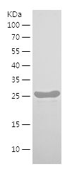    FINE-N2 / Recombinant Human FINE-N2