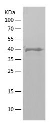    Parkin / Recombinant Human Parkin