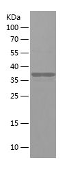    NT5C2 / Recombinant Human NT5C2