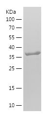    IFITM3 / Recombinant Human IFITM3