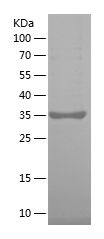    PAR2 / Recombinant Human PAR2