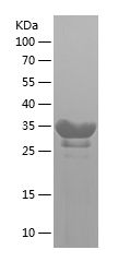    JCHAIN / Recombinant Human JCHAIN