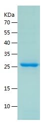    NQO2 / Recombinant Human NQO2