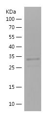    SLC27A2 / Recombinant Human SLC27A2