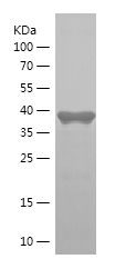    PPRC1 / Recombinant Human PPRC1