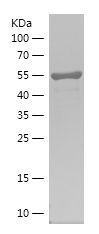    PIP4K2A / Recombinant Human PIP4K2A