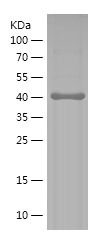    DLG4 / Recombinant Human DLG4