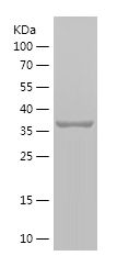    STOML2 / Recombinant Human STOML2