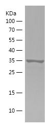    PIN4 / Recombinant Human PIN4