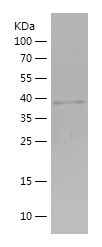    PYGM / Recombinant Human PYGM