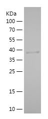    PLA2G12A / Recombinant Human PLA2G12A