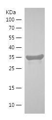    RAB1B / Recombinant Human RAB1B