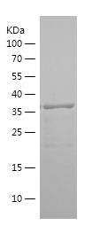    PPARG / Recombinant Human PPARG