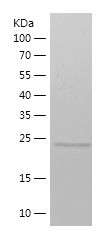    METTL4 / Recombinant Human METTL4