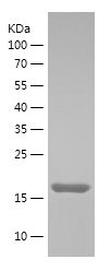    RBM3 / Recombinant Human RBM3