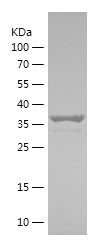    ST1M1 / Recombinant Human ST1M1