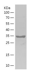    RPL38 / Recombinant Human RPL38