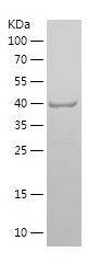    Myoglobin / Recombinant Human Myoglobin