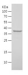    Sur-8 / Recombinant Human Sur-8