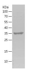    STARD5 / Recombinant Human STARD5