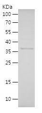    Stathmin / Recombinant Human Stathmin