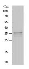    SFMBT2 / Recombinant Human SFMBT2