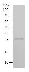    STT3B / Recombinant Human STT3B