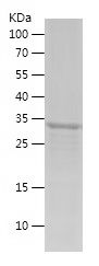    SUMF1 / Recombinant Human SUMF1